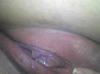 leceanca